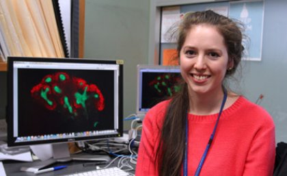 UQ PhD student Elanor Wainwright is one of only 14 people accepted into the Cold Spring Harbor Laboratory’s Mouse Development, Stem Cells and Cancer course in New York from 5-25 June. UQ PhD student Elanor Wainwright is one of only 14 people accepted into the Cold Spring Harbor Laboratory’s Mouse Development, Stem Cells and Cancer course in New York from 5-25 June.