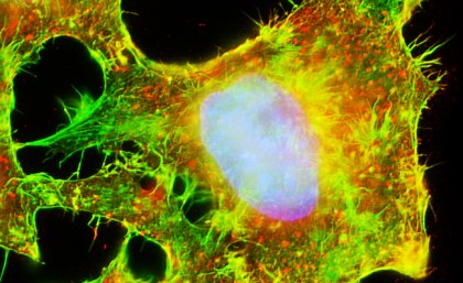 Microscopy image of mammalian cell line used in many fields of biomedical research. Photo courtesy of John Griffin, IMB Microscopy image of mammalian cell line used in many fields of biomedical research. Photo courtesy of John Griffin, IMB
