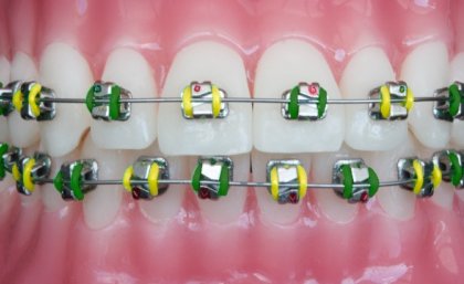 Dentistry PhD student and budding software developer Dr William Ha created the BraceMate app.