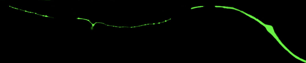 A mechanosensory neuron of C. elegans visible with green fluorescent protein, that is degenerating (fragmentation) due to a mutation in the gene mec-17