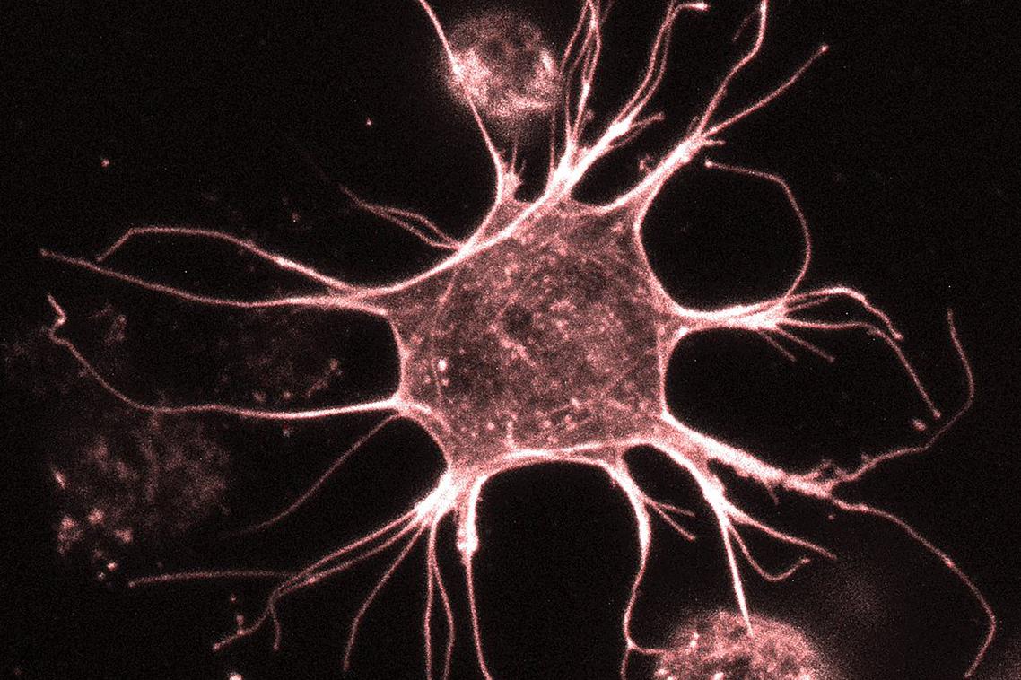 An osteocyte is the most abundant cell in mature bone.