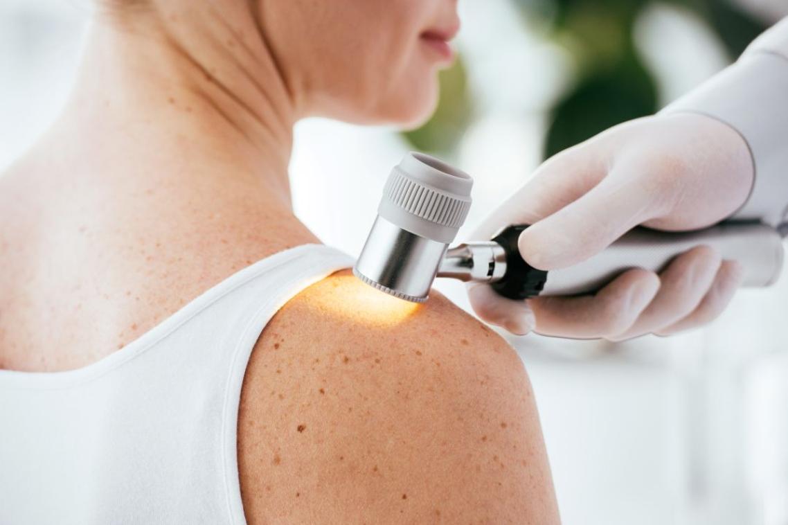 A woman undergoing a physical examination for melanoma by a dermatologist.